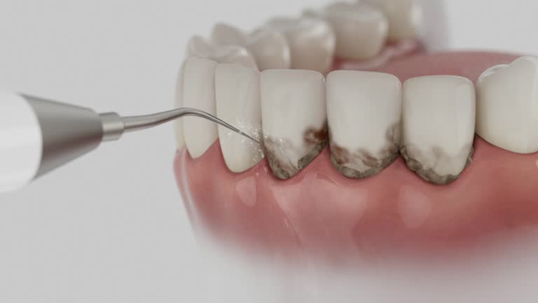Trusted Root Canal Treatment service in San Martin, CA - Dentist Open Now
